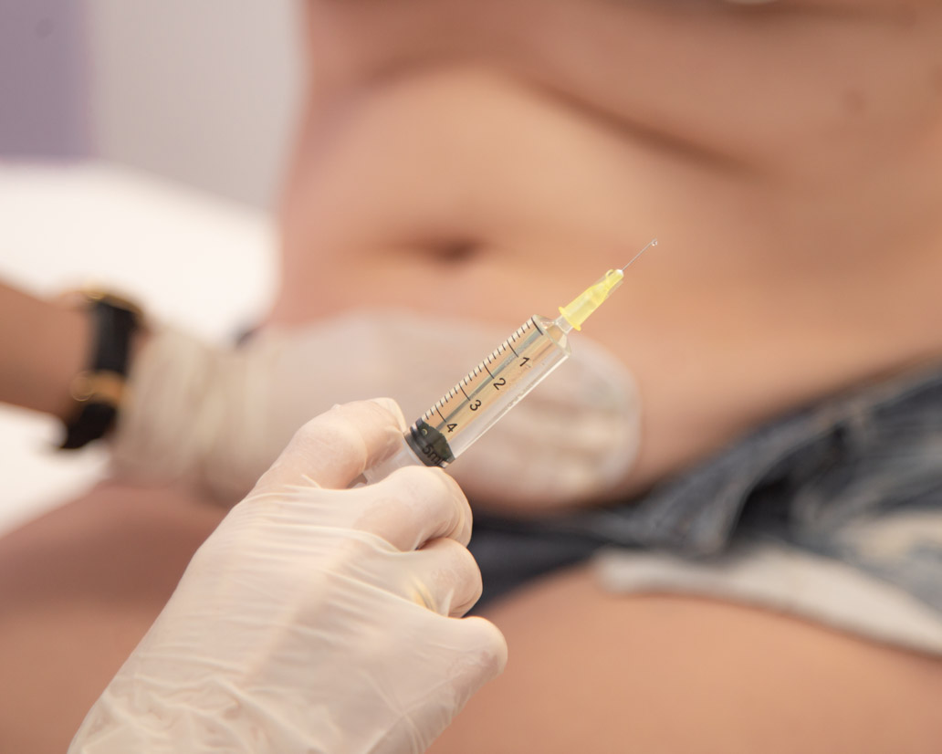 Fat Dissolving Injections